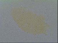 Echiniscus virginicus image