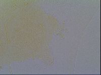 Echiniscus virginicus image