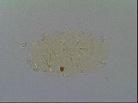 Echiniscus virginicus image
