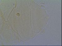Echiniscus virginicus image