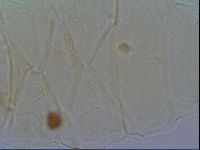 Echiniscus virginicus image