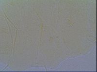 Echiniscus virginicus image