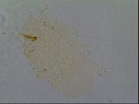 Echiniscus virginicus image