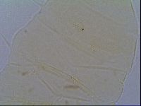 Echiniscus virginicus image