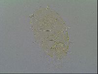 Echiniscus virginicus image