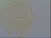 Media resource of Echiniscus virginicus