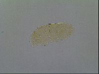 Echiniscus virginicus image