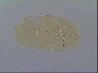 Echiniscus virginicus image