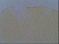Echiniscus virginicus image