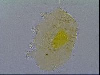 Echiniscus virginicus image