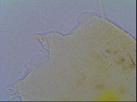 Echiniscus virginicus image