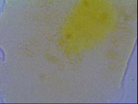 Echiniscus virginicus image