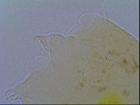 Echiniscus virginicus image