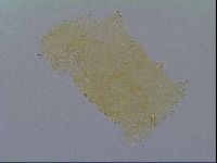 Echiniscus virginicus image