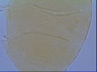 Echiniscus virginicus image