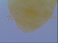 Echiniscus virginicus image