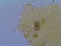 Echiniscus virginicus image