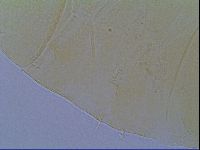 Echiniscus virginicus image