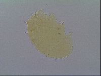 Echiniscus virginicus image