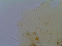 Echiniscus virginicus image