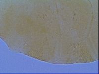 Echiniscus virginicus image