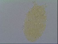 Echiniscus virginicus image