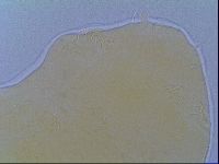 Echiniscus virginicus image