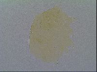 Echiniscus virginicus image