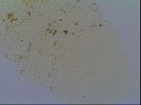 Echiniscus virginicus image