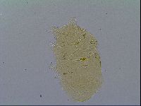 Echiniscus virginicus image