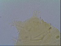 Echiniscus virginicus image
