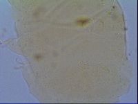 Echiniscus virginicus image