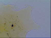 Echiniscus virginicus image