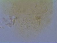 Echiniscus virginicus image