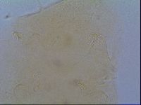 Echiniscus virginicus image