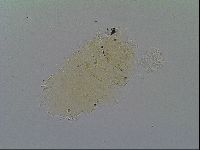 Echiniscus virginicus image