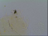 Echiniscus virginicus image