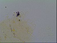 Echiniscus virginicus image