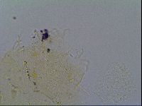 Echiniscus virginicus image