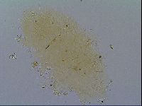 Echiniscus virginicus image