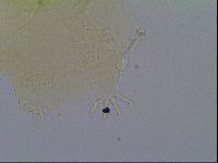 Echiniscus virginicus image