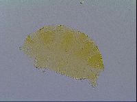Echiniscus virginicus image