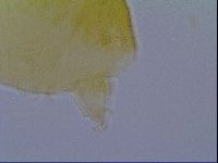 Echiniscus virginicus image