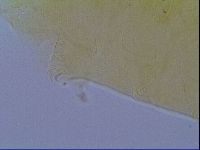 Echiniscus virginicus image