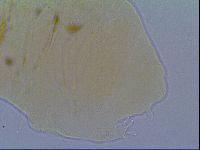 Echiniscus virginicus image