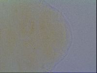 Echiniscus virginicus image