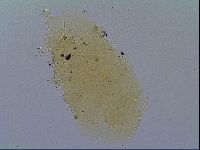 Echiniscus virginicus image