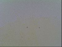 Echiniscus virginicus image