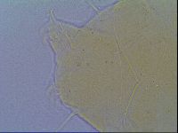 Echiniscus virginicus image