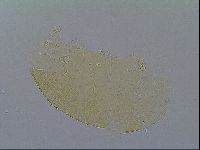 Echiniscus virginicus image